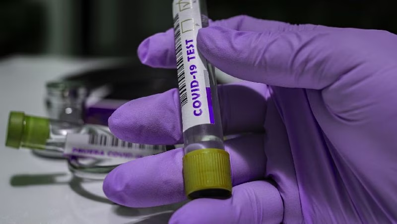 В Казахстане за сутки зарегистрировали 85 случаев заражения коронавирусом
