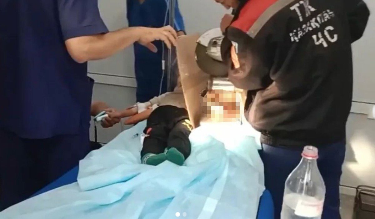 Руку трехлетнего ребенка засосало в электромясорубке в Шымкенте