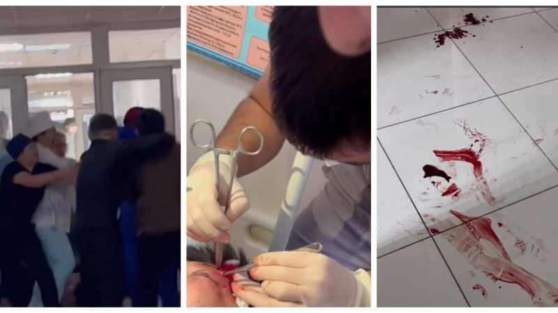 В Минздраве прокомментировали групповое избиение врачей в Талгарской больнице